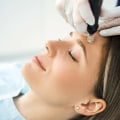 Microneedling After Fitness Center: A Perfect Combo For Healthy, Radiant Skin